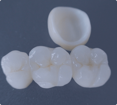 Dental Crowns | Main Street Dental Airdrie