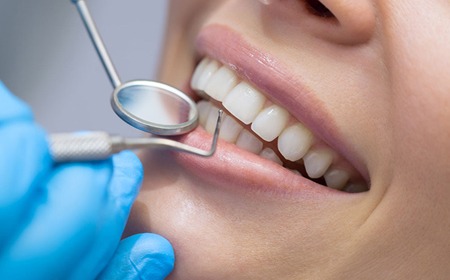Dental Hygiene | Main Street Dental Airdrie